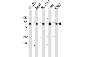 All lanes : Anti-RSL1D1 Antibody (C-Term) at 1:2000 dilution Lane 1: U-2OS whole cell lysate Lane 2: A431 whole cell lysate Lane 3: 293T/17 whole cell lysate Lane 4: Hela whole cell lysate Lane 5: K562 whole cell lysate Lysates/proteins at 20 μg per lane. (RSL1D1 抗体  (AA 455-485))