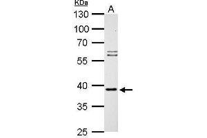 WB Image SAE1 antibody detects SAE1 protein by Western blot analysis. (SAE1 抗体)