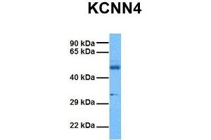 Host:  Rabbit  Target Name:  KCNN4  Sample Tissue:  Human Ovary Tumor  Antibody Dilution:  1. (KCNN4 抗体  (C-Term))