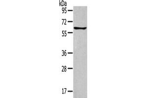 Gel: 8 % SDS-PAGE,Lysate: 40 μg,Primary antibody: ABIN7129612(GLP2R Antibody) at dilution 1/400 dilution,Secondary antibody: Goat anti rabbit IgG at 1/8000 dilution,Exposure time: 1 minute (GLP2R 抗体)