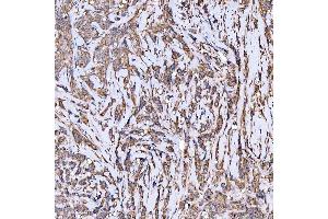 IHC analysis of Syntaxin 18/STX18 using anti-Syntaxin 18/STX18 antibody (ABIN7599259).