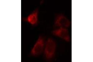 ABIN6275024 staining LOVO cells by IF/ICC. (CCDC102A 抗体  (Internal Region))