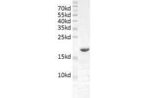 Western Blotting (WB) image for SWI/SNF Related, Matrix Associated, Actin Dependent Regulator of Chromatin, Subfamily A, Member 4 (SMARCA4) (AA 1448-1569) protein (His tag,DYKDDDDK Tag) (ABIN2669664)