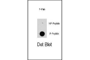 Dot blot analysis of anti-raptor-p Pab (R) on nitrocellulose membrane. (RAPTOR 抗体  (pSer863))