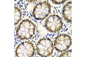 Immunohistochemistry of paraffin-embedded human colon using SNRPE Antibody (ABIN1876676) at dilution of 1:100 (40x lens). (SNRPE 抗体)