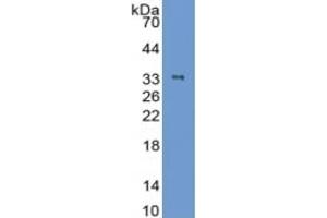 Rabbit Capture antibody from the kit in WB with Positive Control: Sample Human Skeletal muscle lysate. (Cardiac Troponin T2 CLIA Kit)