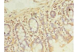 Immunohistochemistry of paraffin-embedded human small intestine tissue using ABIN7167776 at dilution of 1:100