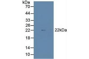 Detection of MAX in Porcine Heart Tissue using Polyclonal Antibody to MYC Associated Factor X (MAX) (MAX 抗体  (AA 2-160))