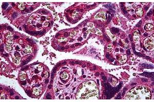 Human Placenta, Trophoblast: Formalin-Fixed, Paraffin-Embedded (FFPE) (ERBB3 抗体  (AA 1-131))