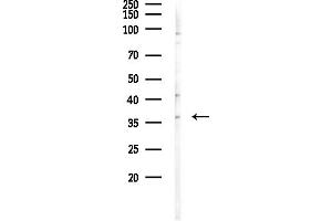 Western blot analysis of lysates from F10-LUC cells(heat-shock,45 min treatment), using OR1E2 Antibody at 1/1000 dilution.