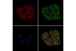 ABIN6261244 and ABIN6279380 staining Hela cells by IF/ICC. (Dynactin 4 抗体  (Internal Region))