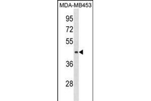 ALG8 Antibody (N-term) (ABIN1539057 and ABIN2850016) western blot analysis in MDA-M cell line lysates (35 μg/lane). (ALG8 抗体  (N-Term))
