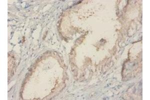 Immunohistochemistry (IHC) image for anti-TROVE Domain Family, Member 2 (TROVE2) (AA 3-535) antibody (ABIN7142715)