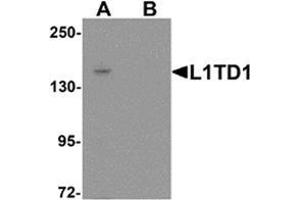 Western blot analysis of L1TD1 in Jurkat cell lysate with L1TD1 antibody at 1 ug/mL in (A) the absence and (B) the presence of blocking peptide. (L1TD1 抗体  (C-Term))