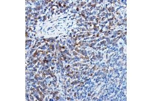 Immunohistochemistry of paraffin-embedded mouse spleen using Bax Rabbit mAb  at dilution of 1:25,1:50 (40x lens). (BAX 抗体)