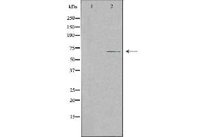 Western blot analysis of extracts from Jurkat cells, using SLC28A2 antibody.