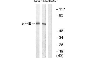 Immunohistochemistry analysis of paraffin-embedded human colon carcinoma tissue using eIF4B (Ab-422) antibody. (EIF4B 抗体)