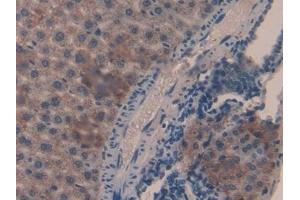Detection of CAT in Mouse Liver Tissue using Polyclonal Antibody to Catalase (CAT) (Catalase 抗体  (AA 32-157))