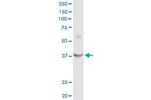 FRZB MaxPab rabbit polyclonal antibody. (FRZB 抗体  (AA 1-325))