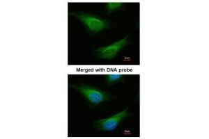 ICC/IF Image Immunofluorescence analysis of paraformaldehyde-fixed HeLa, using FANCC, antibody at 1:200 dilution. (FANCC 抗体  (Center))