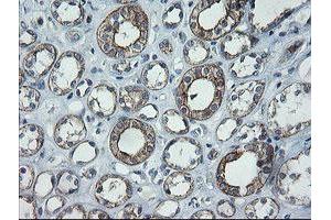 Image no. 4 for anti-Chromosome 2 Open Reading Frame 62 (C2orf62) antibody (ABIN1497054) (C2orf62 抗体)