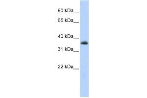 WB Suggested Anti-MNX1 Antibody Titration:  0. (MNX1 抗体  (N-Term))