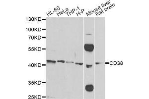Western blot analysis of extracts of various cell lines, using CD38 Antibody (ABIN5970838) at 1/500 dilution. (CD38 抗体)