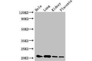 Western Blot Positive WB detected in: Hela whole cell lysate, Mouse lung tissue, Mouse kidney tissue, Human placenta tissue All lanes: KRBOX4 antibody at 3. (KRAB Box Domain Containing 4 (KRBOX4) (AA 1-98) 抗体)