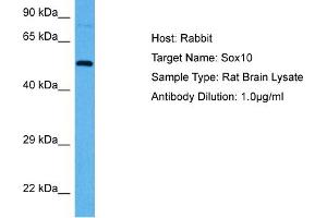Host:  Rabbit  Target Name:  SOX10  Sample Tissue:  Rat Brain  Antibody Dilution:  1ug/ml