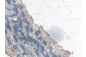 Immunohistochemistry (IHC) image for anti-Arylsulfatase A (ARSA) antibody (ABIN7441370)