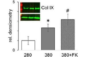 FK506 dose-dependently stimulates expression of fibrillar and minor collagens in physosmotic ATDC5 cultures.