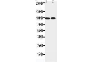 Western Blotting (WB) image for anti-erythrocyte Membrane Protein Band 4.1-Like 1 (EPB41L1) (AA 585-604), (C-Term) antibody (ABIN3042566) (EPB41L1 抗体  (C-Term))