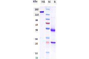 Anti-CXCR5 / CD185 Reference Antibody (SAR113244) on SDS-PAGE under reducing (R) condition.