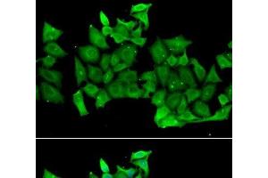 Immunofluorescence analysis of MCF-7 cells using RHOH Polyclonal Antibody (RHOH 抗体)