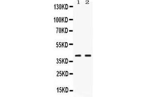 Western blot analysis of PSAT1 expression in rat pancreas extract ( Lane 1) and HELA whole cell lysates ( Lane 2). (PSAT1 抗体  (AA 276-370))