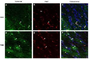 Immunohistochemical staining of perfusion-fixed frozen rat brain sections derived from post-natal day 22 (PN22) and from post-natal day 60 (PN60), using Anti-TMEM108 (extracellular) Antibody (ABIN7885615), followed by goat anti-rabbit- and Anti-OLIG2 Antibody, followed by goat anti-mouse-biotin and streptavidin-Cy3. (TMEM108 抗体  (Extracellular Loop))