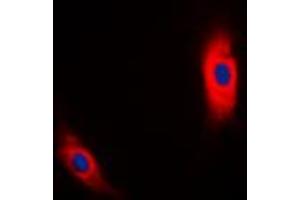 Immunofluorescent analysis of CK1 alpha staining in MCF7 cells. (CSNK1A1 抗体  (Center))