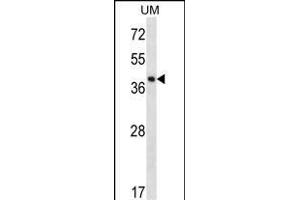 SPOPL Antibody (Center) (ABIN656695 and ABIN2845929) western blot analysis in uterus tumor cell line lysates (35 μg/lane).