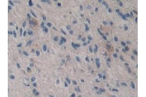 Immunohistochemistry (IHC) image for anti-Glutathione S-Transferase theta 2 (GSTT2) (AA 15-235) antibody (ABIN7432193)