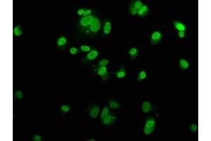 Immunofluorescence staining of MCF-7 cells with ABIN7150328 at 1:200, counter-stained with DAPI. (MCM2 抗体  (AA 2-904))