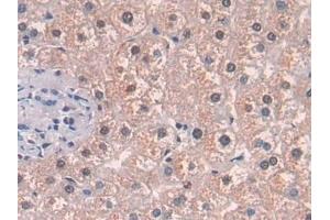 Immunohistochemistry (IHC) image for anti-Methionine Adenosyltransferase II, alpha (MAT2A) (AA 176-395) antibody (ABIN7436291)