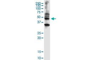 ABHD5 monoclonal antibody (M01), clone 1F3. (ABHD5 抗体  (AA 1-349))