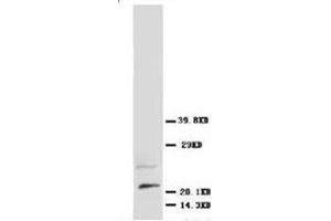 Western blot analysis of rat brain tissue lysis using NGFbeta antibody (Nerve Growth Factor 抗体  (N-Term))