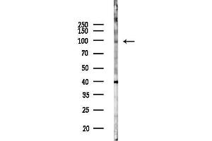 anti-DEAD/H (Asp-Glu-Ala-Asp/His) Box Polypeptide 26B (DDX26B) antibody