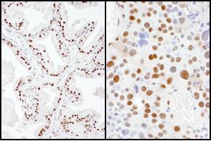 Immunohistochemistry (IHC) image for anti-SUMO1 Activating Enzyme Subunit 2 (UBA2) (AA 590-640) antibody (ABIN7454884)