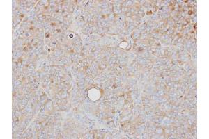 IHC-P Image Immunohistochemical analysis of paraffin-embedded SW480 xenograft, using PRPS1, antibody at 1:500 dilution. (PRPS1 抗体)