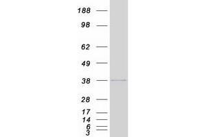 HIST1H1C Protein (Myc-DYKDDDDK Tag)