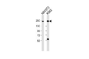 Western Blotting (WB) image for anti-SWI/SNF Related, Matrix Associated, Actin Dependent Regulator of Chromatin, Subfamily A, Member 4 (SMARCA4) (AA 1352-1386), (C-Term) antibody (ABIN6242372)