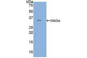 Western blot analysis of recombinant Mouse FUCa1.