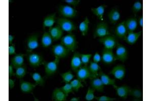 Immunofluorescence staining of A549 cells with ABIN7156973 at 1:133, counter-stained with DAPI. (IFT172 抗体  (AA 1368-1502))
